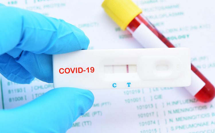Where to Get Your Covid-19 Test to Return Home